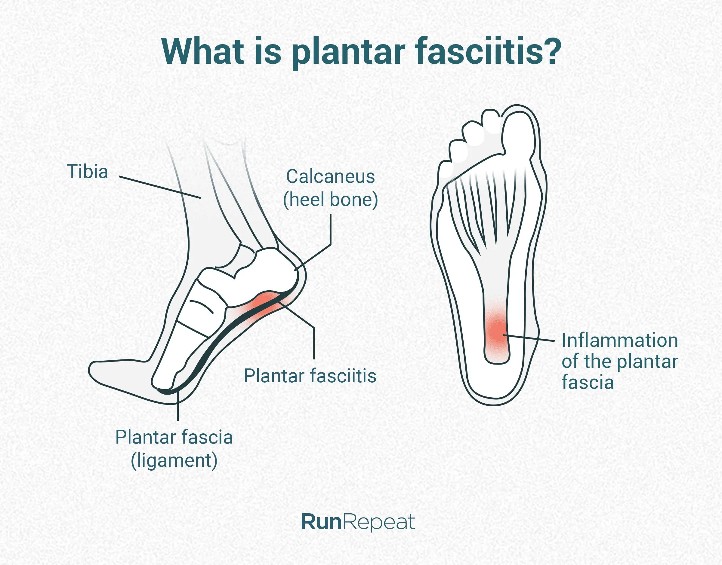 post-Best Hiking Shoes for Ladies with Plantar Fasciitis: Expert Guide 2025